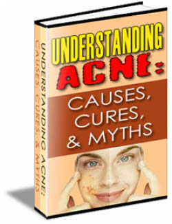 Understanding Acne: Causes, Cures, & Myths